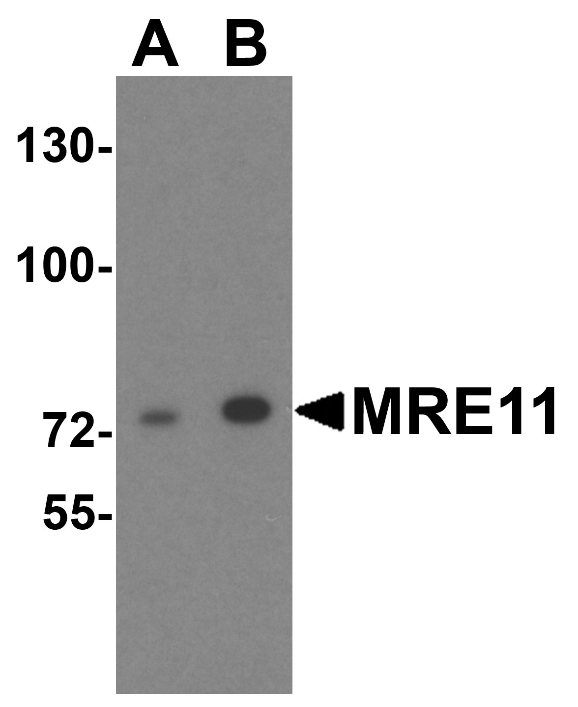 MRE11 Antibody
