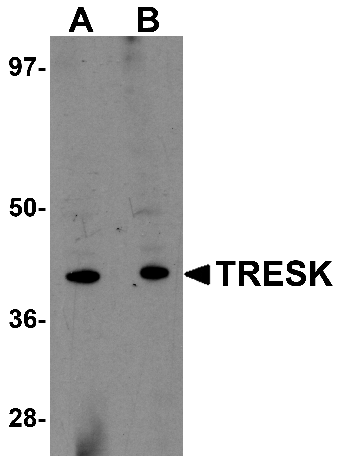 TRESK Antibody