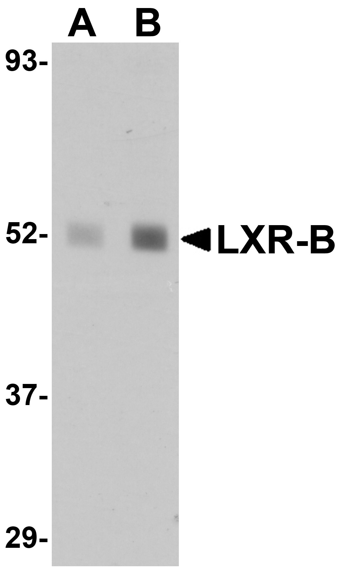 LXR-B Antibody