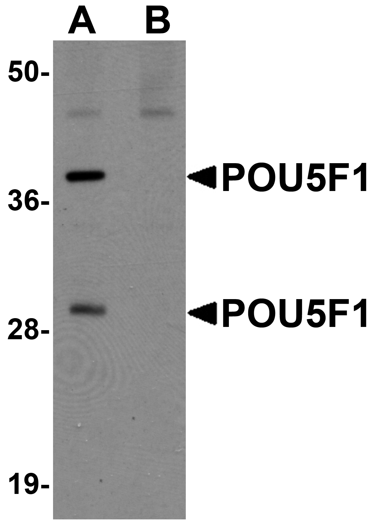 POU5F1 Antibody