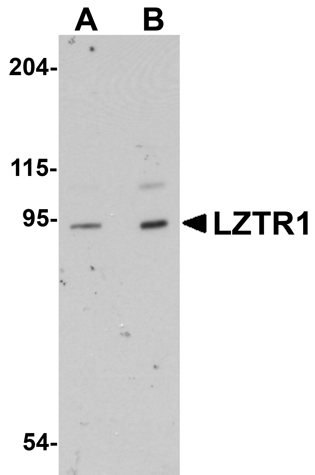 LZTR1 Antibody