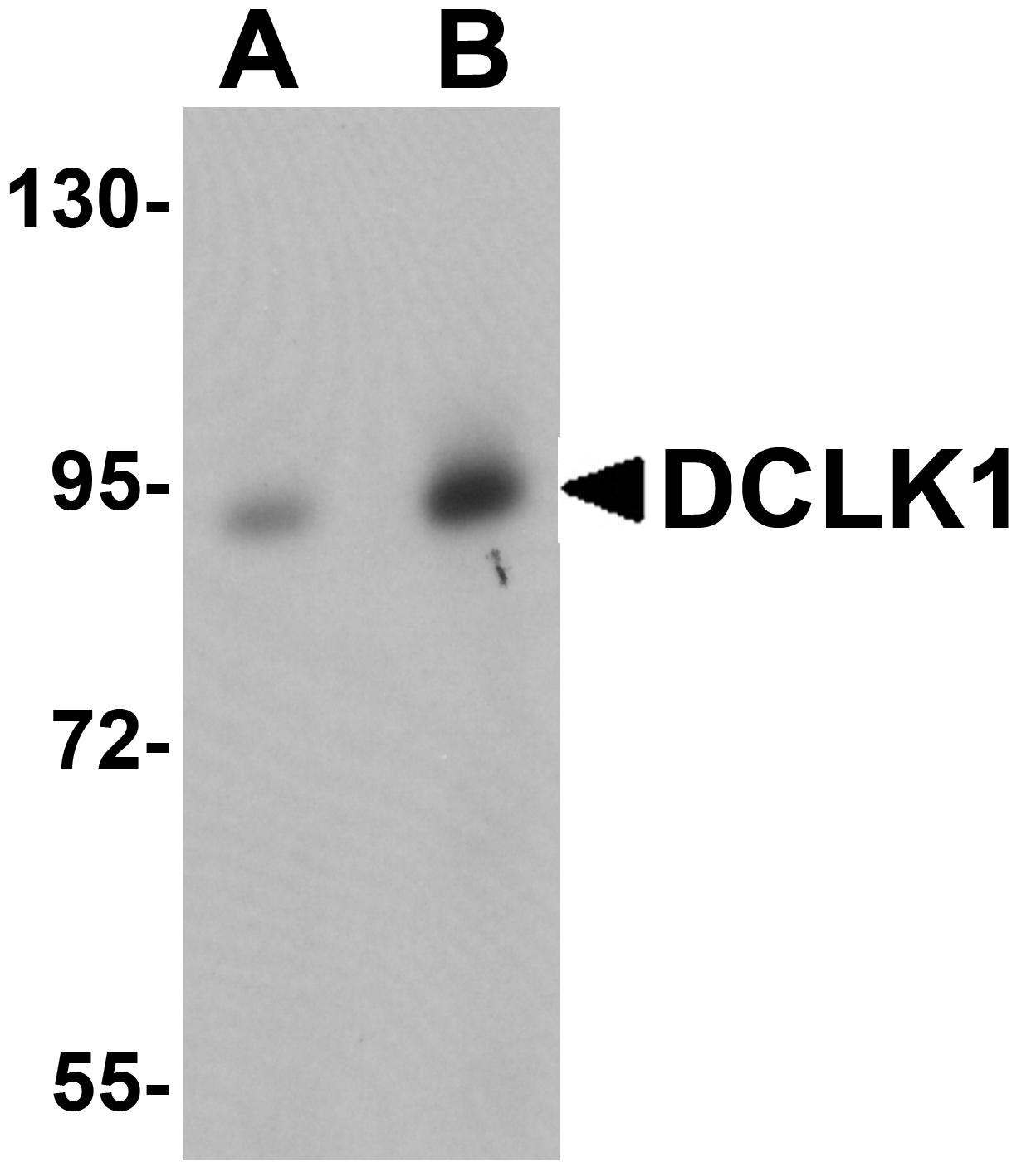 DCLK1 Antibody