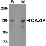 Western blot analysis of CAZIP in A20 cell lysate with CAZIP antibody at (A) 0.5 and (B) 1 μg/mL.