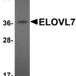 Western blot analysis of ELOVL7 in human liver tissue lysate with ELOVL7 antibody at 1 μg/mL.