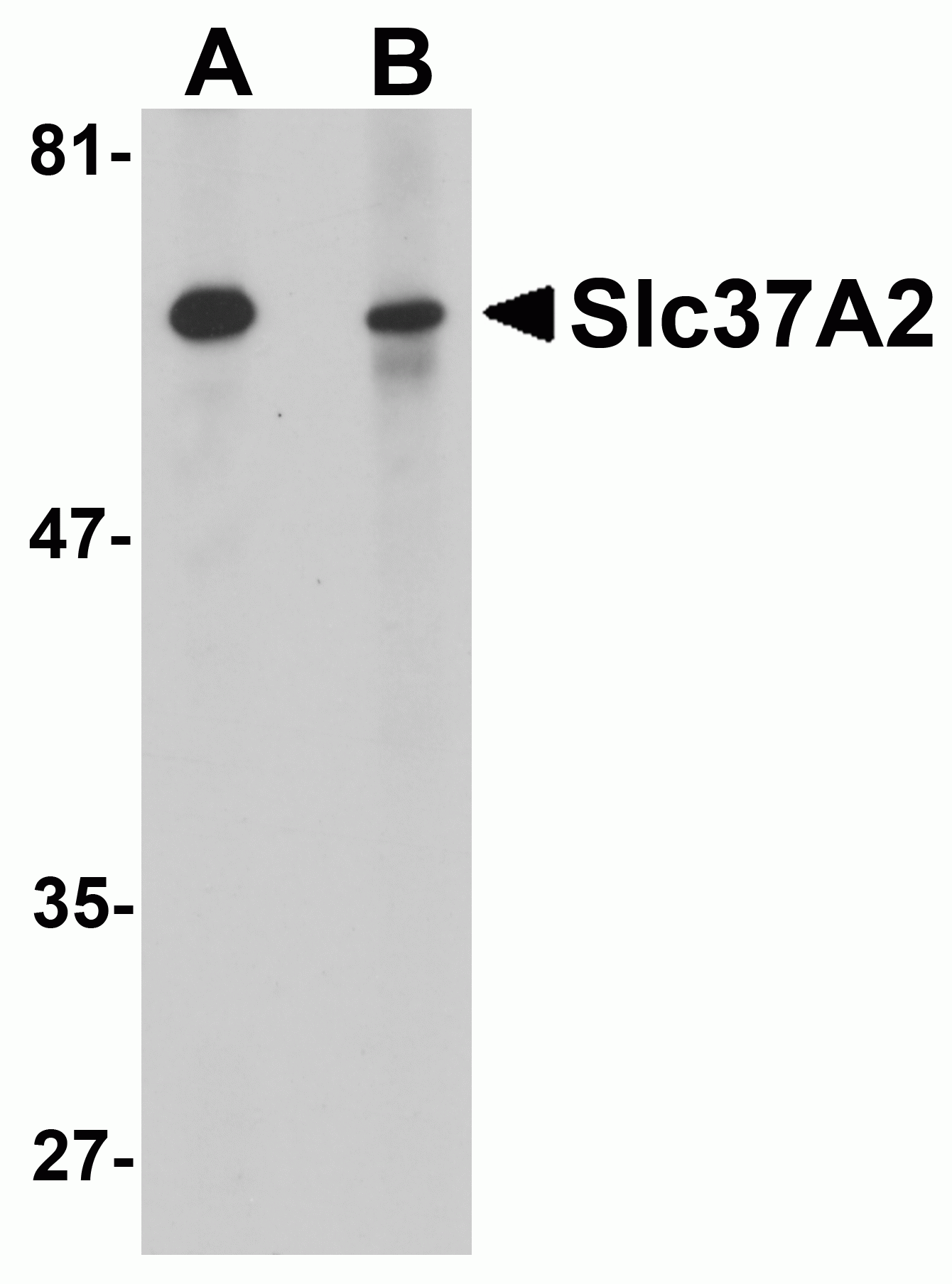 Slc37A2 Antibody