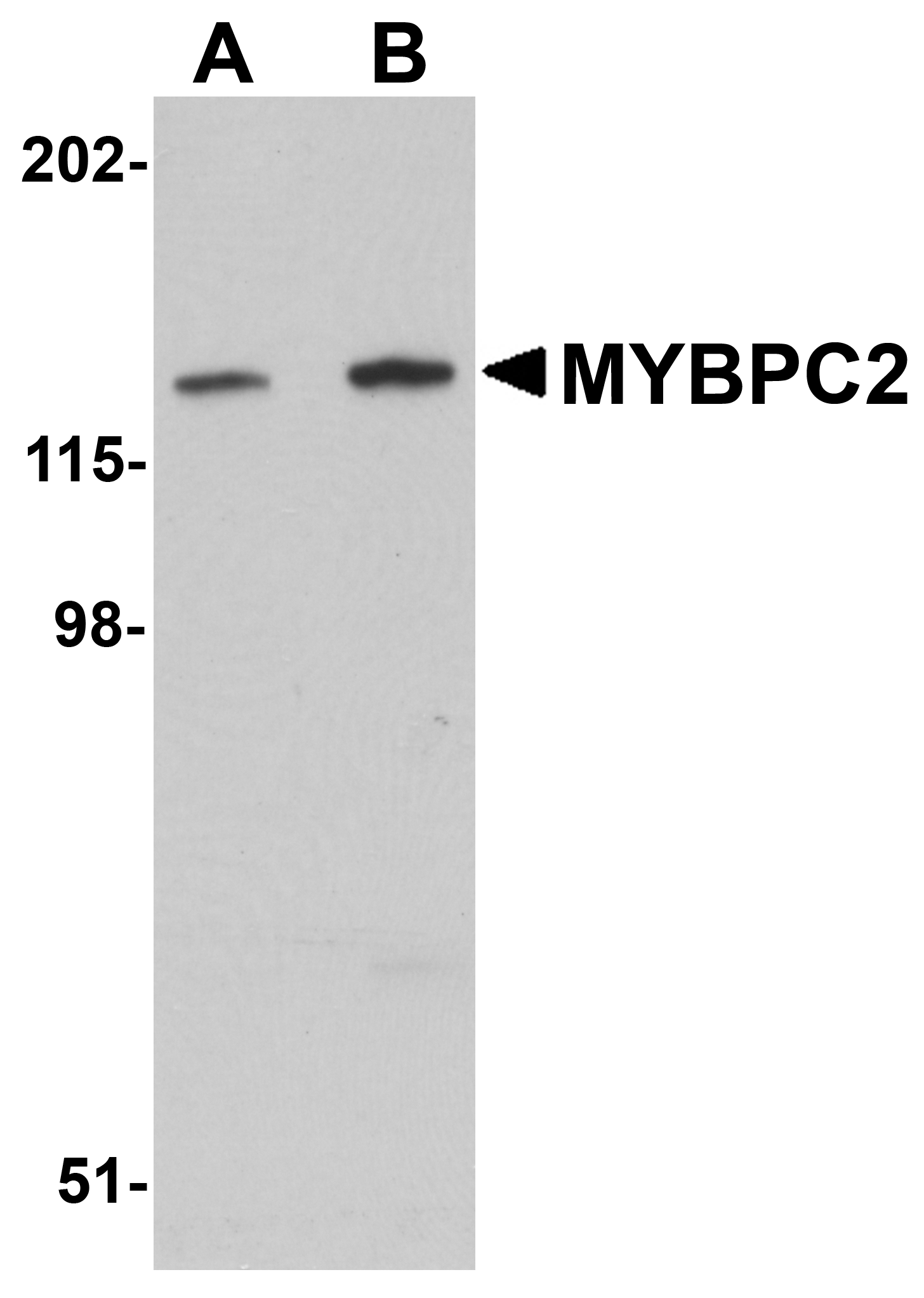 MYBPC2 Antibody