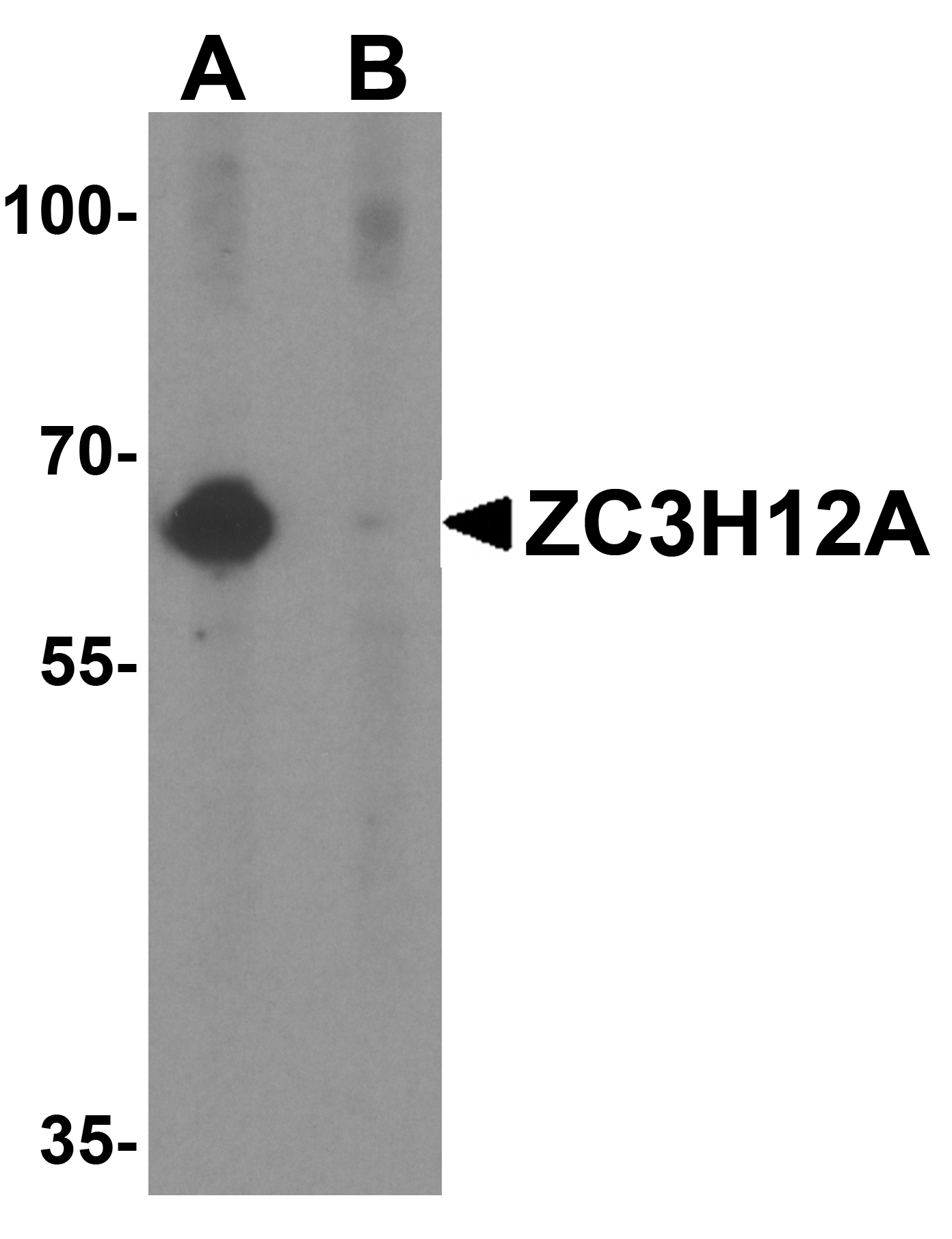 ZC3H12A Antibody