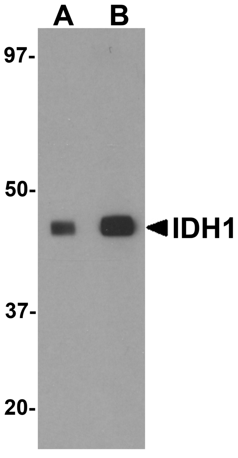 IDH1 Antibody