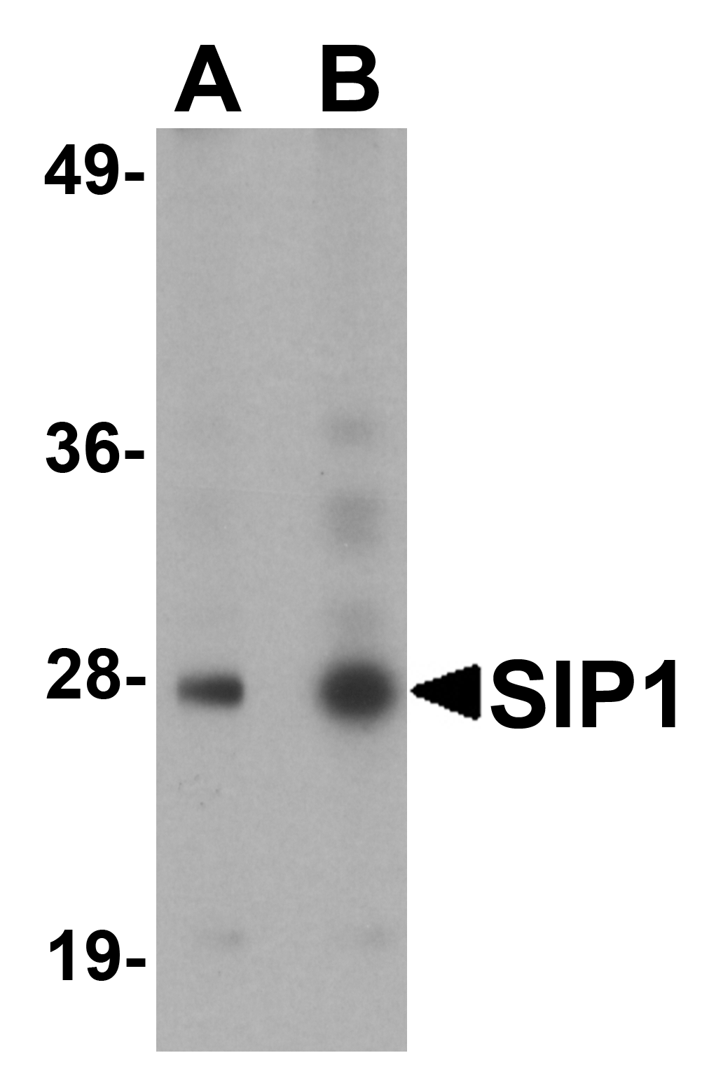 SIP1 Antibody