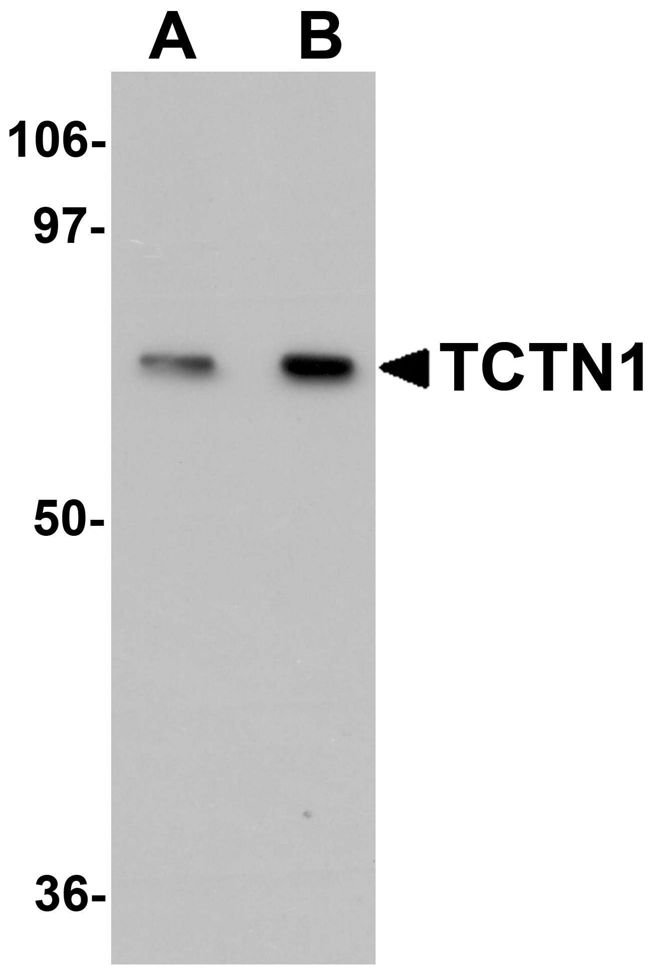 TCTN1 Antibody