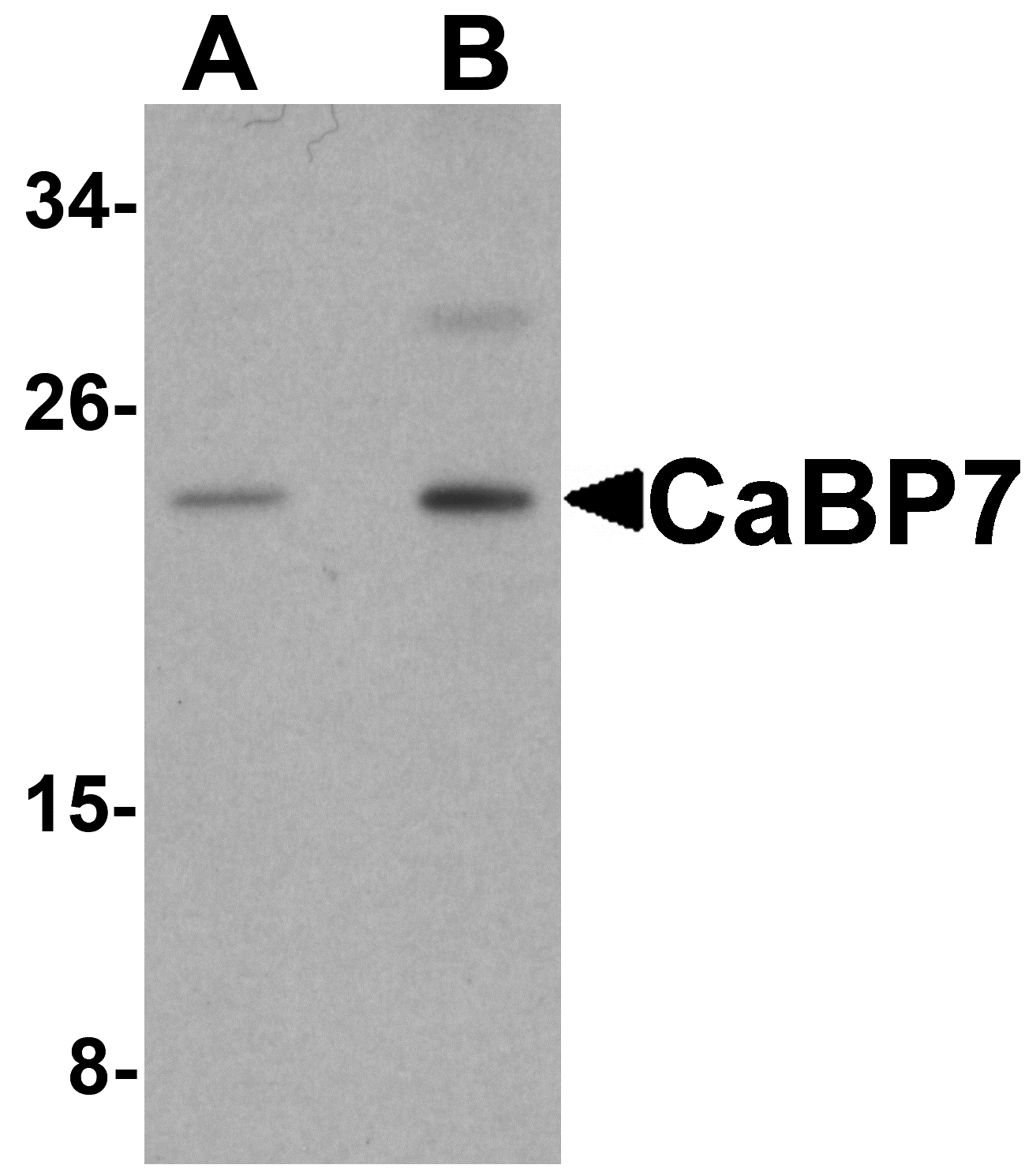 CaBP7 Antibody