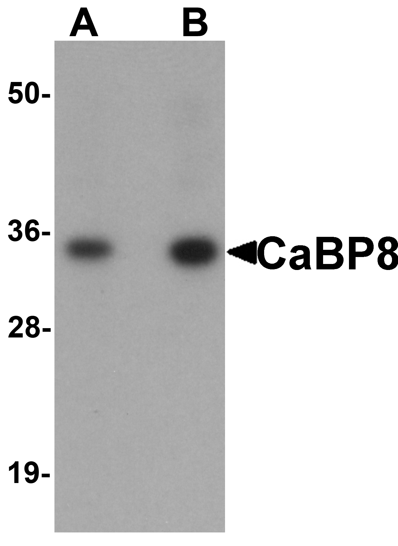 CaBP8 Antibody