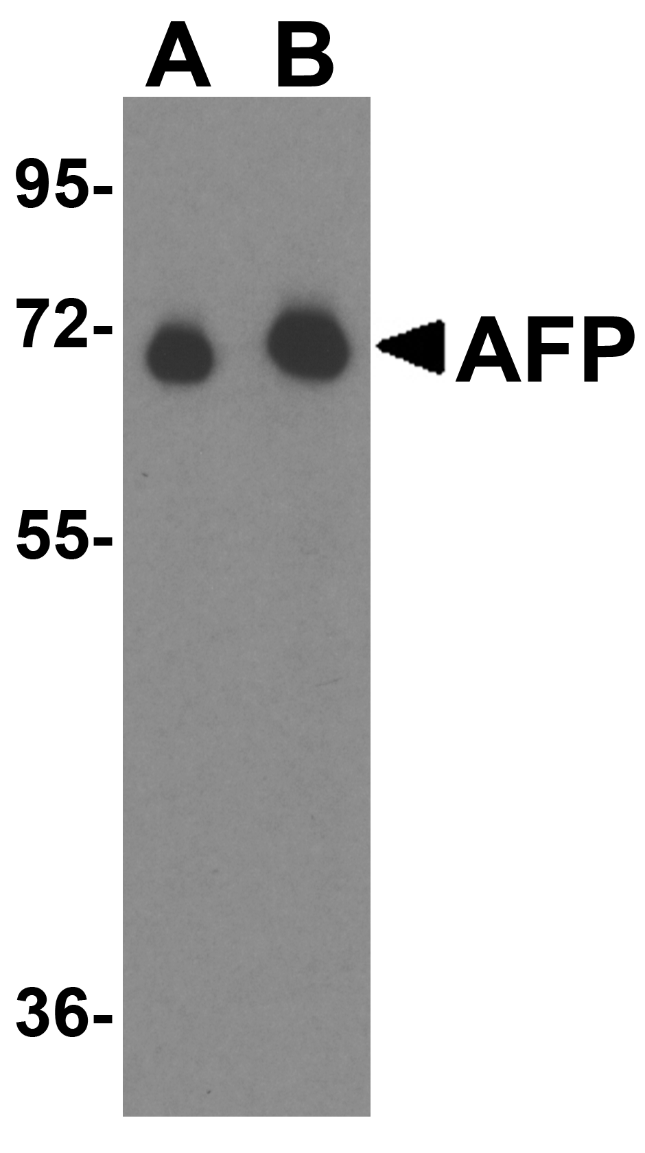 AFP Antibody