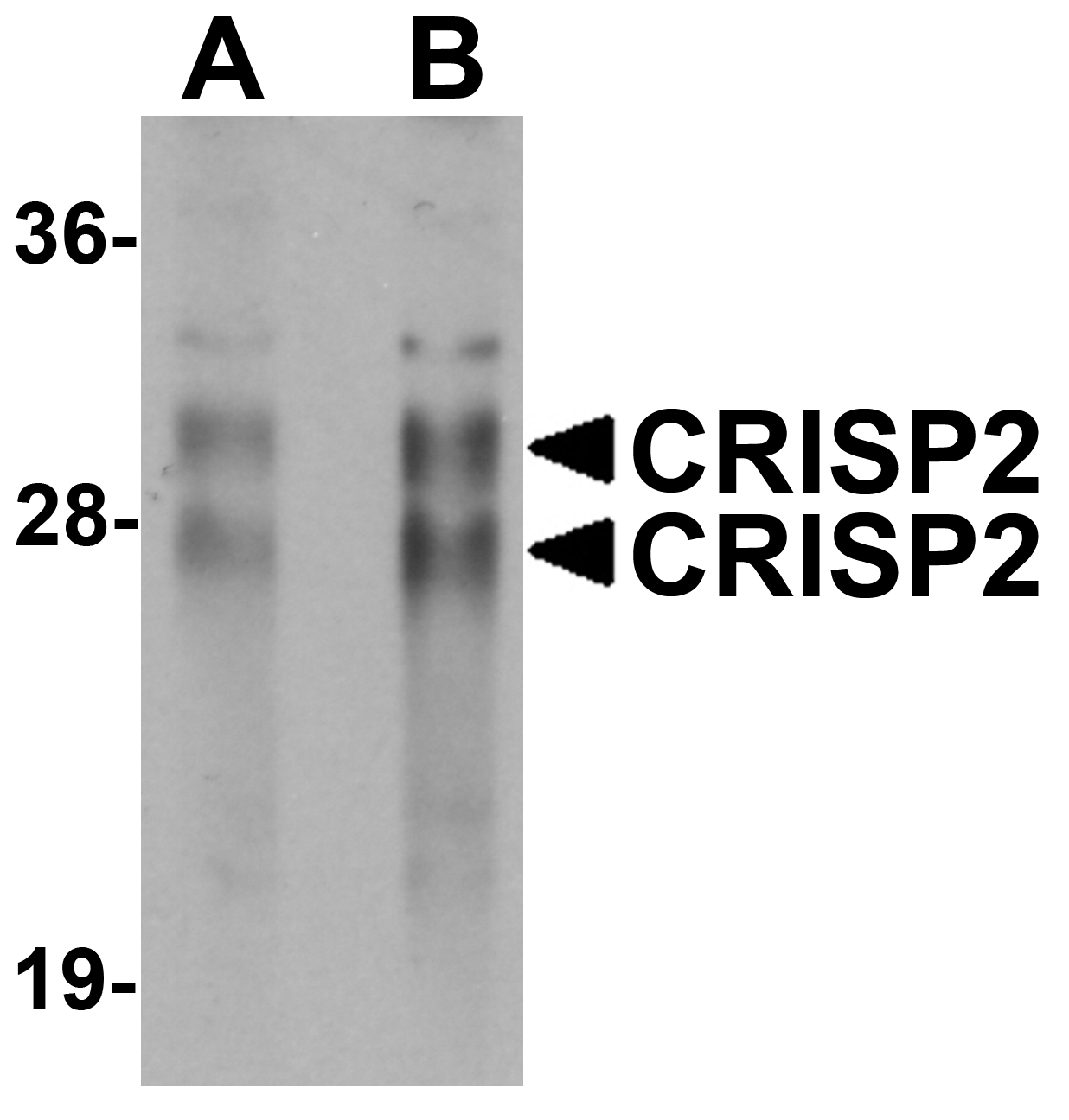 CRISP2 Antibody