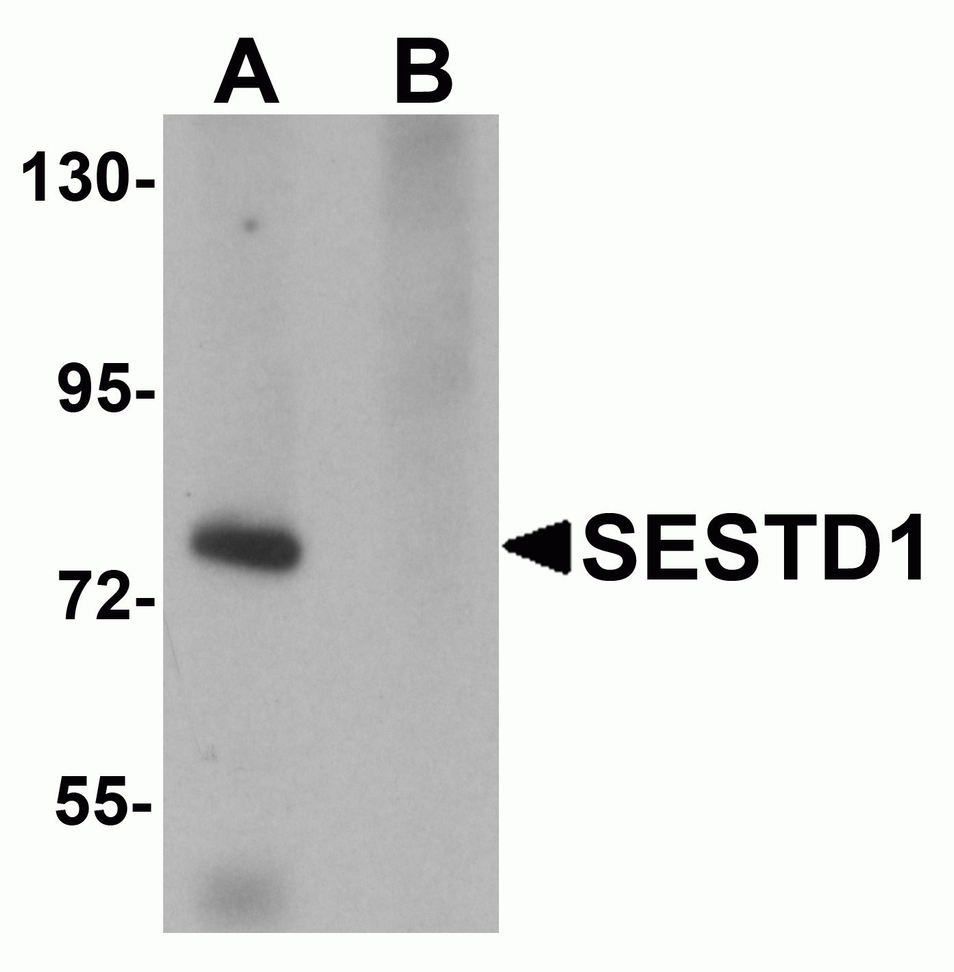 SESTD1 Antibody