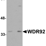 Western blot analysis of WDR92 in human kidney tissue lysate with WDR92 antibody at (A) 1 and (B) 2 μg/mL.