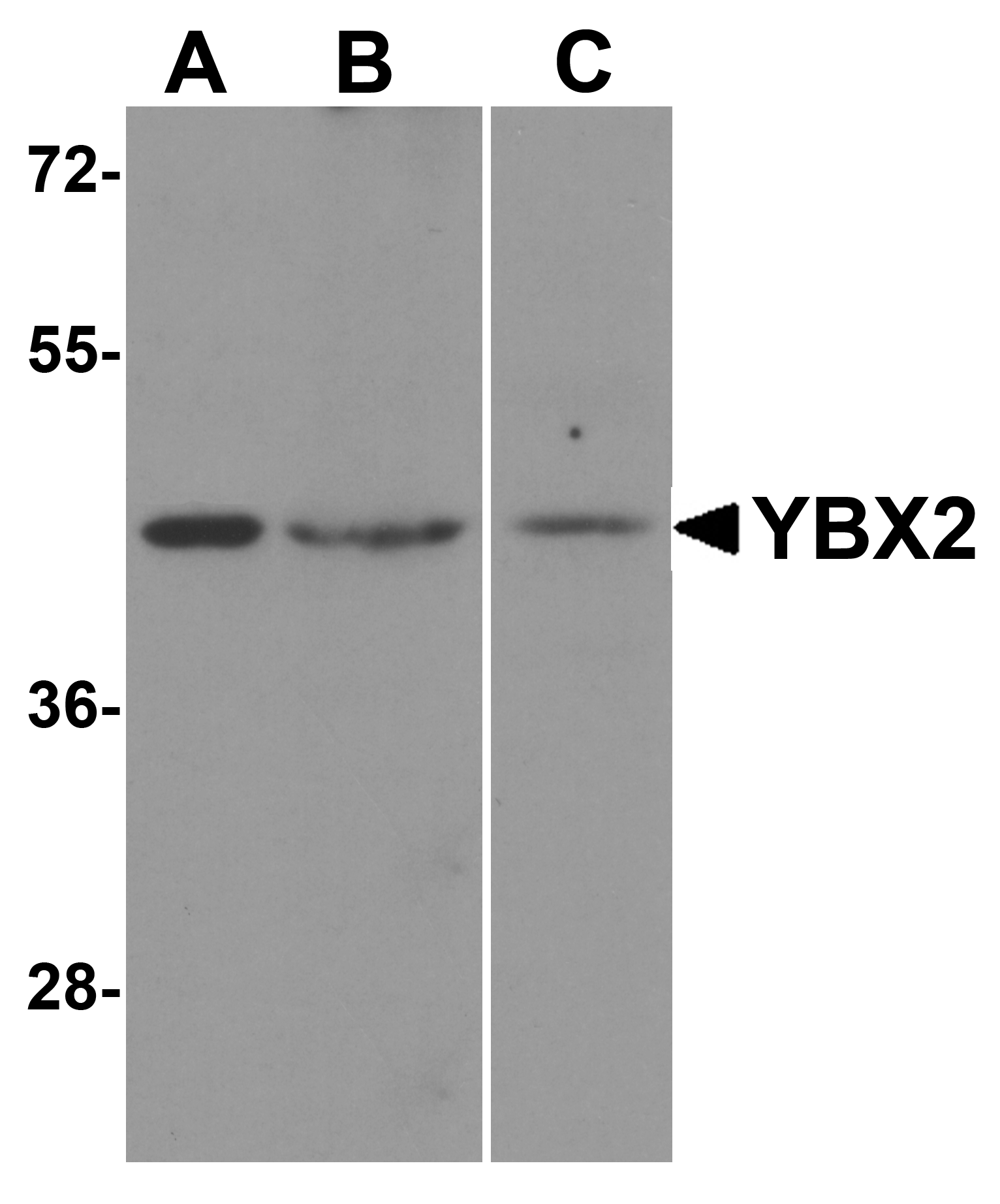 YBX2 Antibody