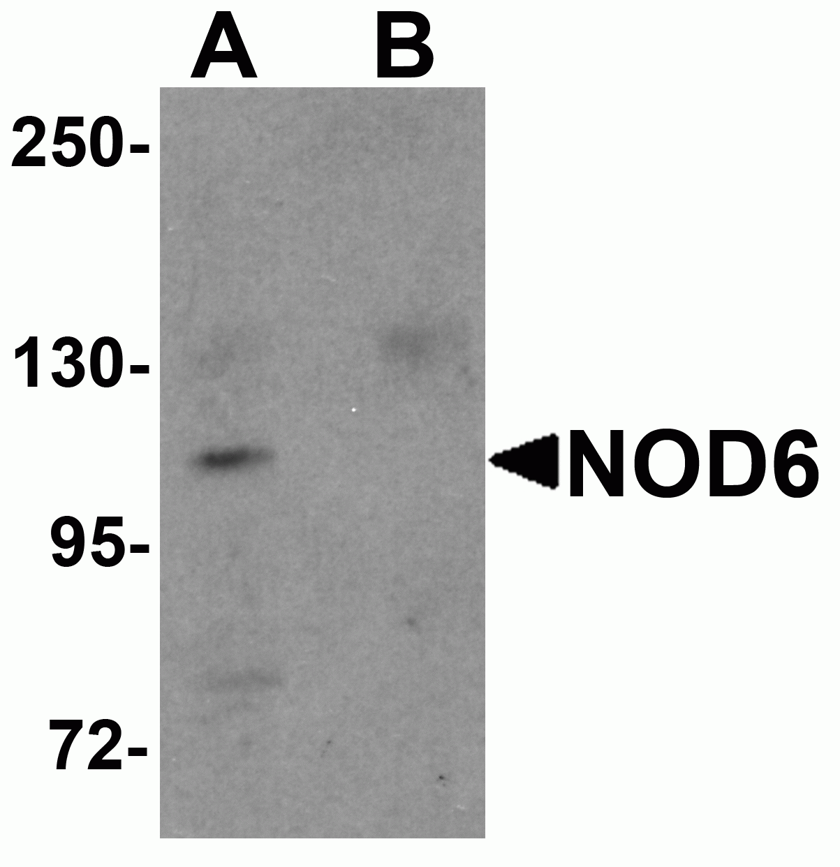 NOD6 Antibody
