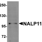 Western blot analysis of NALP11 in HeLa cell lysate with NALP11 antibody at 1 μg/mL.