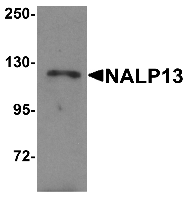 NALP13 Antibody