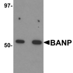 Western blot analysis of BANP in mouse kidney tissue lysate with BANP antibody at (A) 1 and (B) 2 μg/mL.