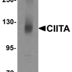 Western blot analysis of CIITA in rat brain tissue lysate with CIITA antibody at 1 μg/mL.