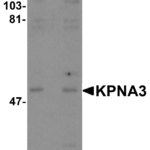 Western blot analysis of KPNA3 in EL4 cell lysate with KPNA3 antibody at (A) 1 and (B) 2 μg/mL.