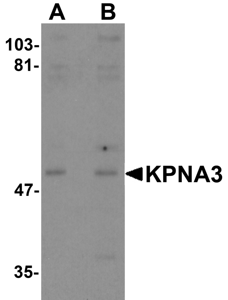 KPNA3 Antibody