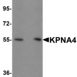 Western blot analysis of KPNA4 in HeLa cell lysate with KPNA4 antibody at (A) 0.5 and (B) 1 μg/mL.