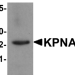 Western blot analysis of KPNA6 in 293 cell lysate with KPNA6 antibody at 1 μg/mL.