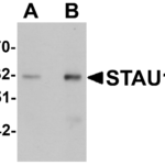 Western blot analysis of STAU1 in rat brain tissue lysate with STAU1 antibody at (A) 1 and (B) 2 μg/mL.