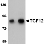 Western blot analysis of TCF12 in HeLa cell lysate with TCF12 antibody at (A) 0.5 and (B) 1 μg/mL.