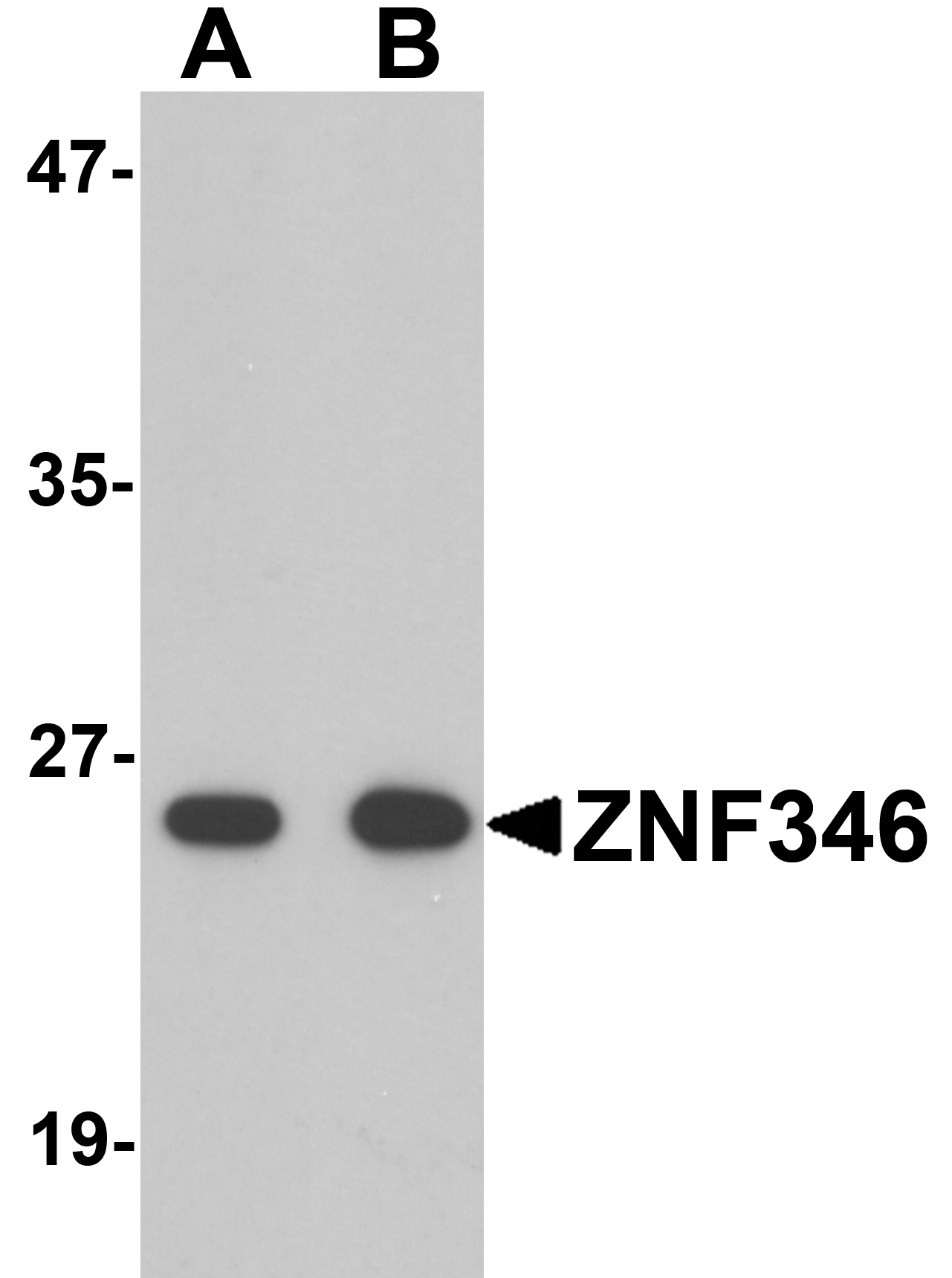 ZNF346 Antibody