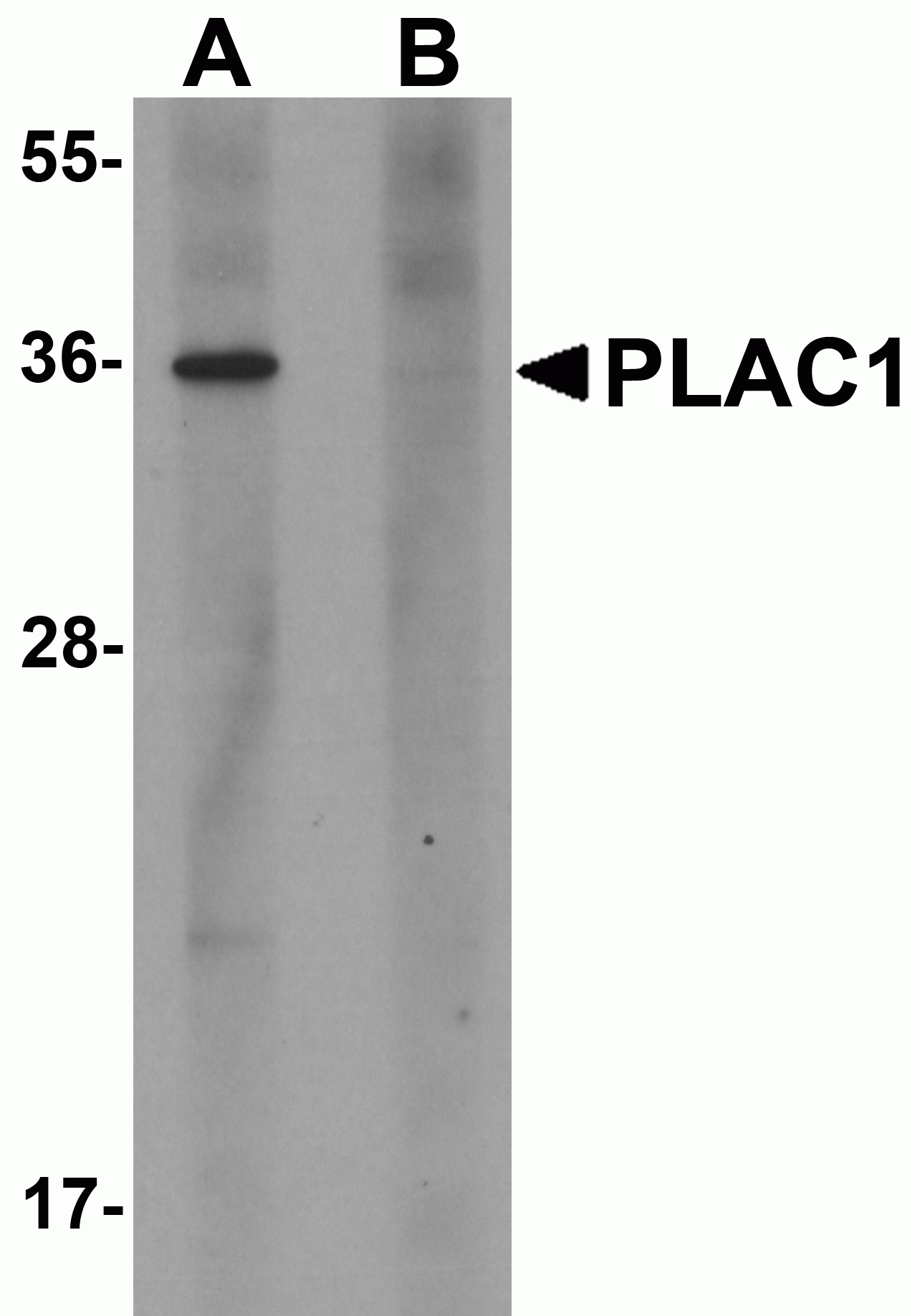PLAC1 Antibody