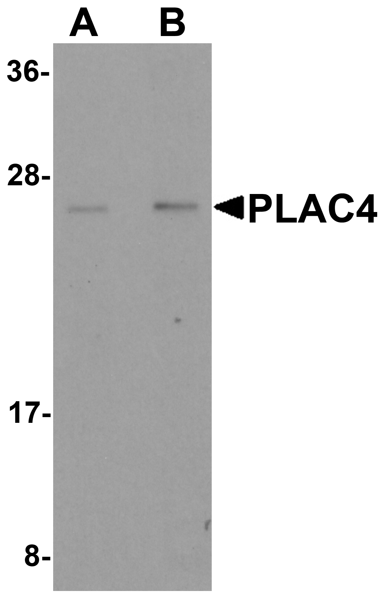 PLAC4 Antibody