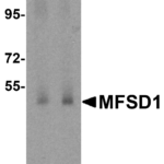 Western blot analysis of MFSD1 in human testis tissue lysate with MFSD1 antibody at (A) 1 and (B) 2 μg/mL.