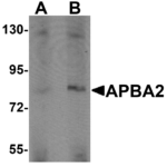 Western blot analysis of APBA2 in human brain tissue lysate with APBA2 antibody at (A) 1 and (B) 2 μg/mL.