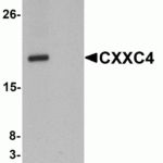 Western blot analysis of CXXC4 in human brain tissue lysate with CXXC4 antibody at 1 μg/mL in (A) the absence and (B) the presence of blocking peptide.