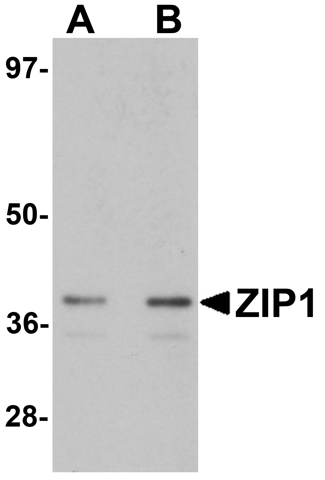 ZIP1 Antibody