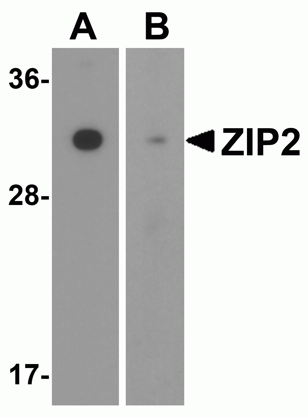 ZIP2 Antibody
