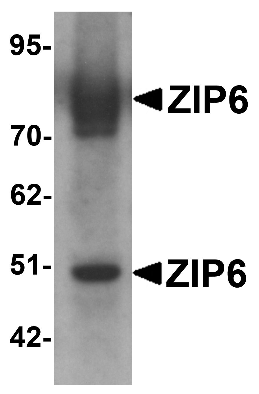 ZIP6 Antibody