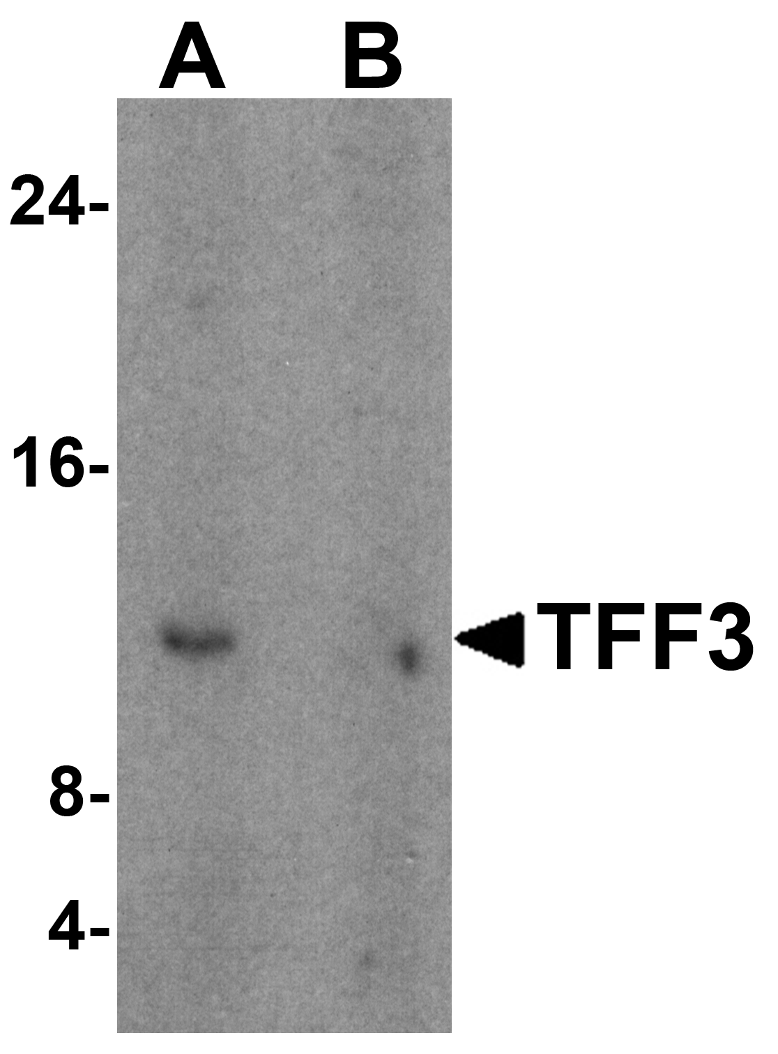 TFF3 Antibody