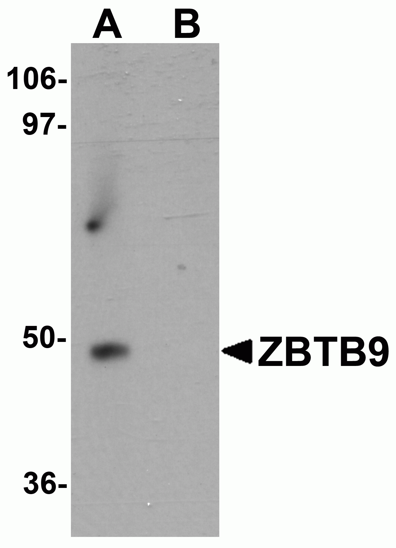 ZBTB9 Antibody