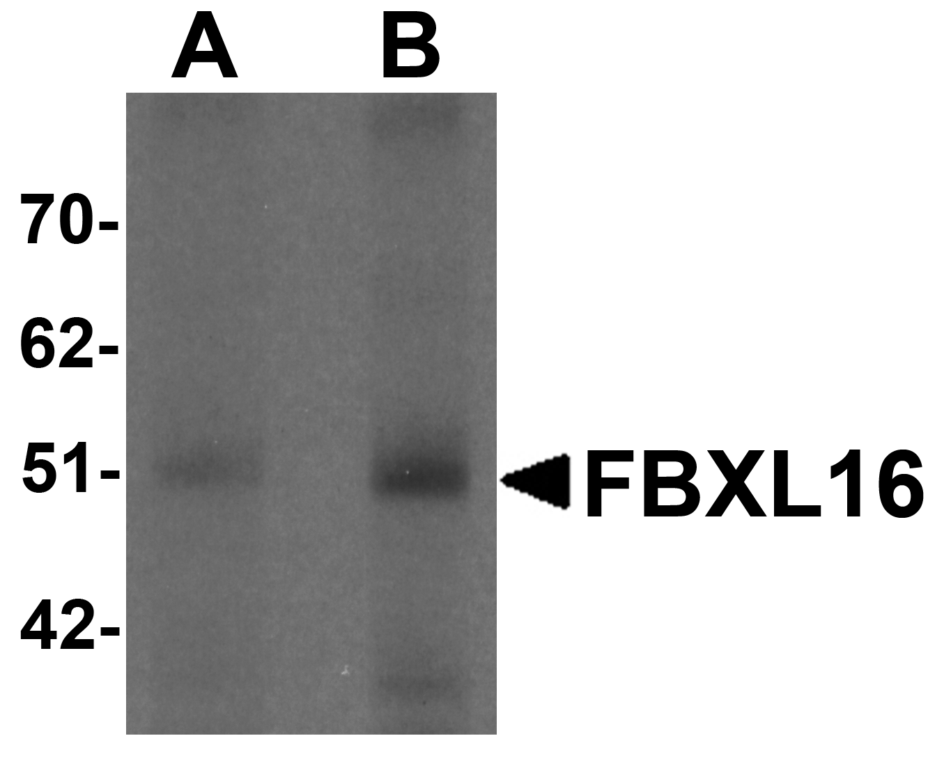 FBXL16 Antibody