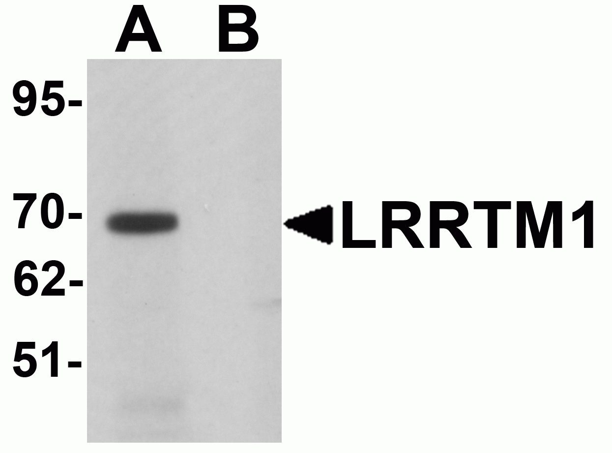 LRRTM1 Antibody