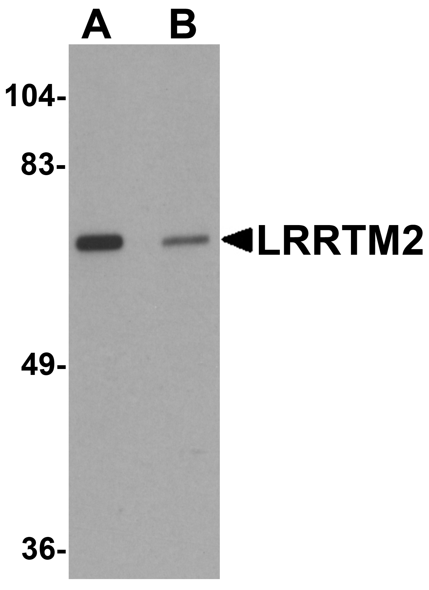 LRRTM2 Antibody
