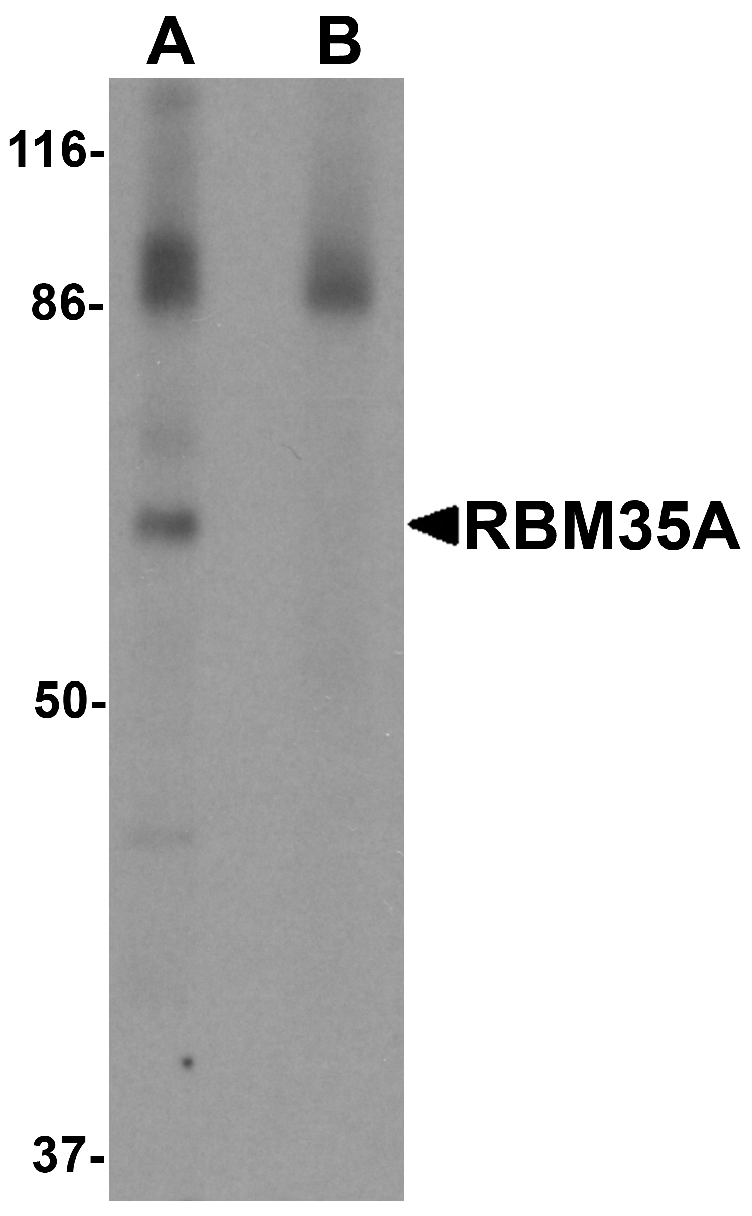 RBM35A Antibody
