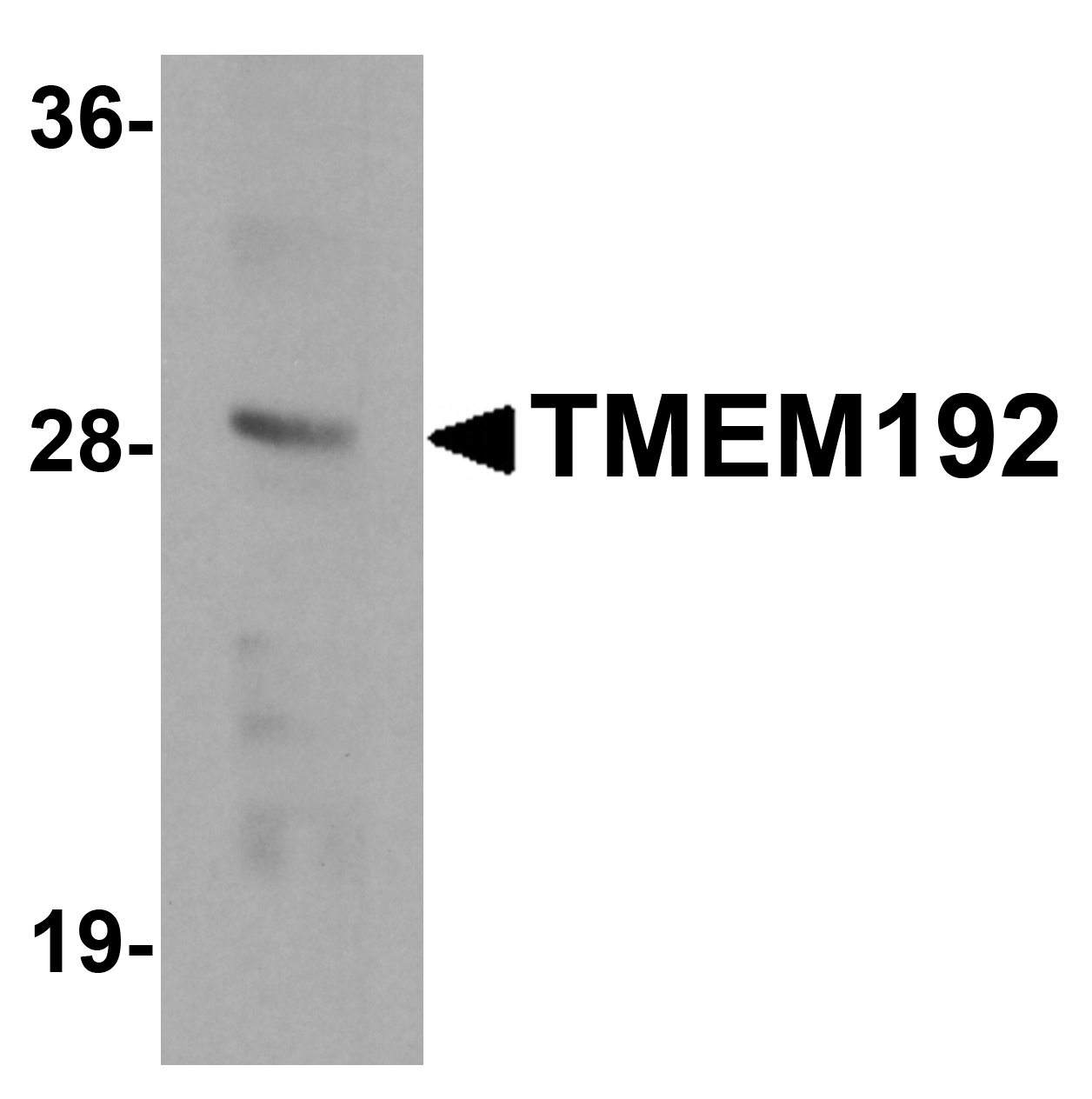 TMEM192 Antibody