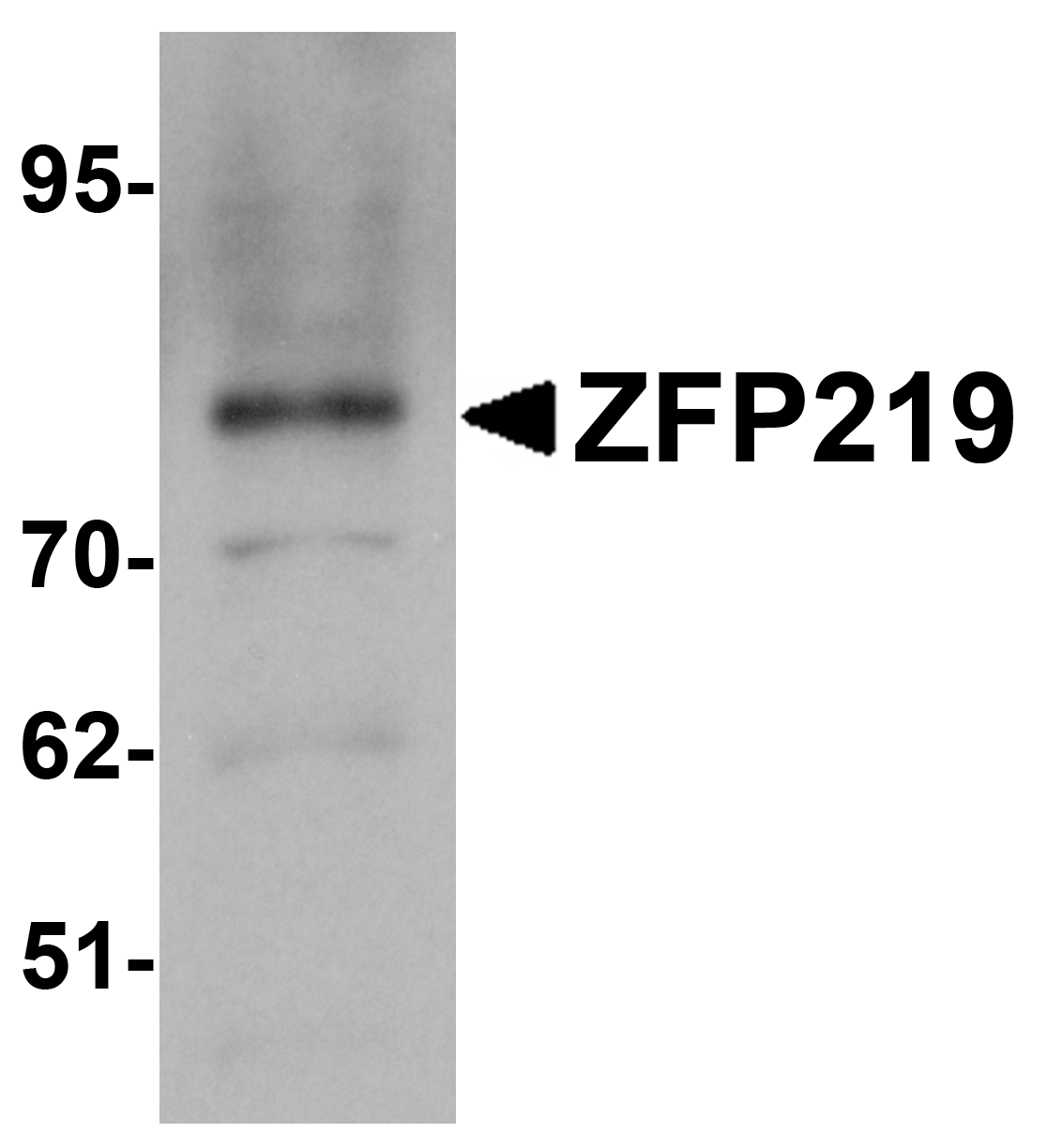 ZFP219 Antibody