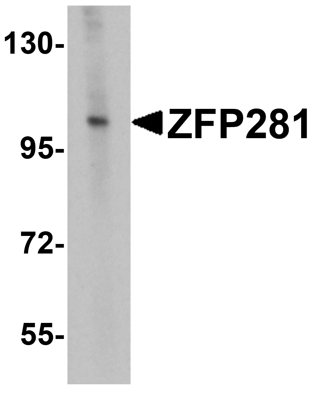ZFP281 Antibody